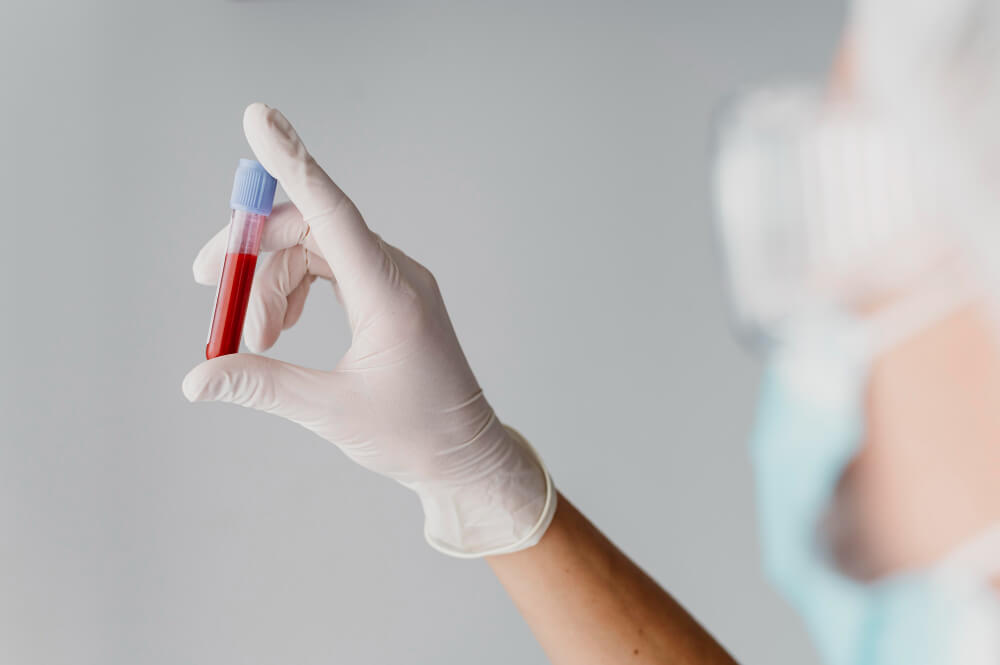 Diagnosing Herpes