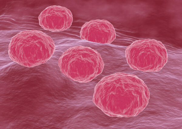 Chlamydia trachomatis is a sexually transmitted bacterium that causes chlamydiasis in humans