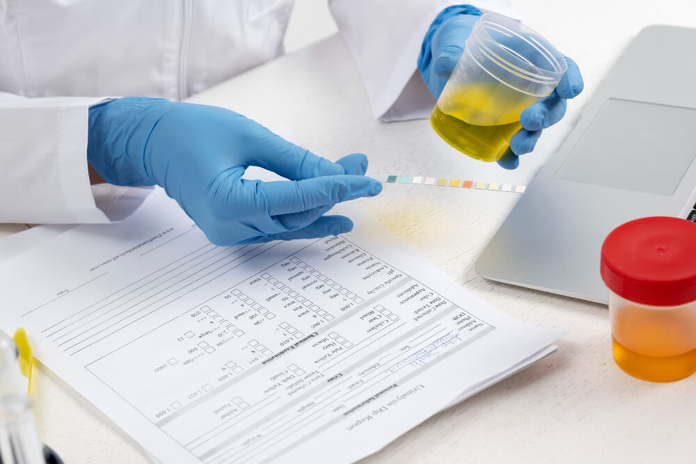 Chlamydia Testing Methods