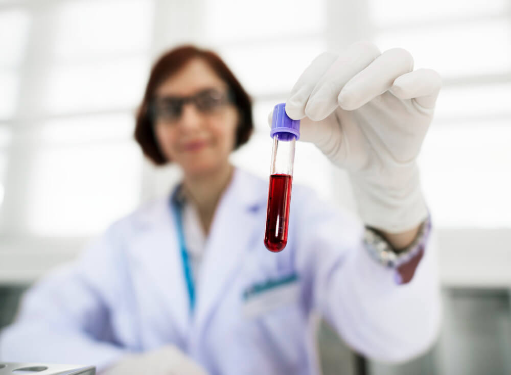 Hepatitis b and c testing