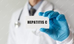 hepatitis C