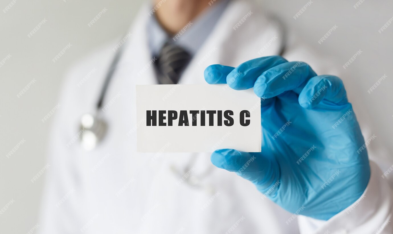 hepatitis C