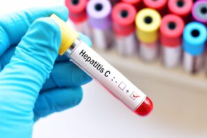 Hepatitis C Care